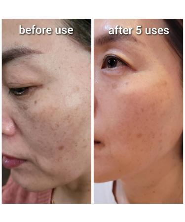 Hydrogen Dual Skin Changer Set | Hydrating Anti-Aging K-Beauty Therapy | International Shipping - Buy Online on SooperMarket.com