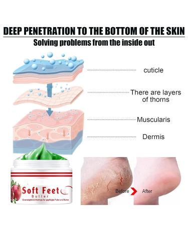 Pomegranate Hand and Foot Cream | Repair Dry Cracked Heels & Chapped Skin | Moisturizing Salve with Pomegranate Extract & Peppermint | International Shipping Available - Buy Online on SooperMarket.com