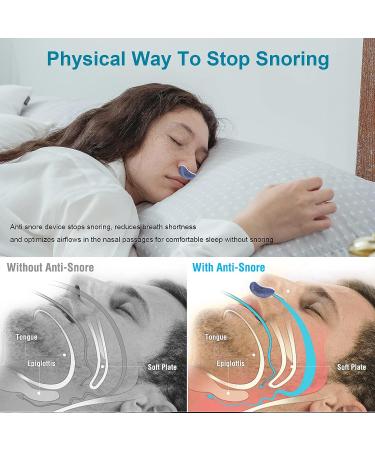 Electric Anti Snoring Nasal Dilators - Snoring Solution for Men and Women - Blue - Buy Online on SooperMarket.com