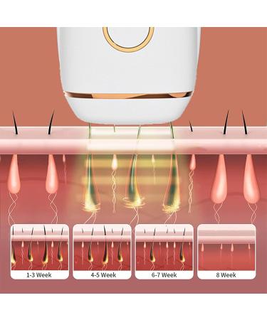 Laserrazor IPL Hair Removal - Portable & Effective for Whole Body | Best International Shipping - Buy Online on SooperMarket.com