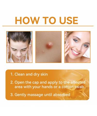 FROPUN Bee Venom Treatment Cream | Acne & Skin Repair | Hydrating Cream for Men & Women | 1 Fl Oz - Buy Online on SooperMarket.com