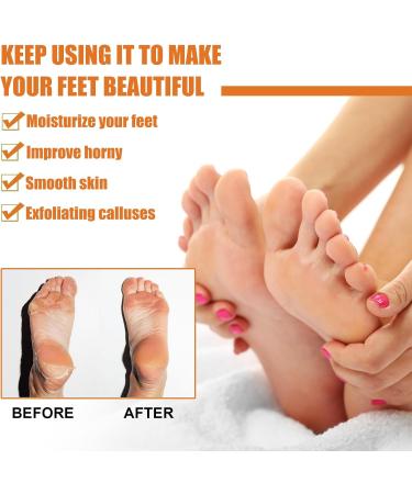 Tongyend Foot Peeling Spray Foot Callus Removal Spray Foot Peel Spray Instant Foot Peeling Spray Orange Oil Soften& Moisturize Peel-Off Spray for Cracked Rough Dry Skin Foot Care - Buy Online on SooperMarket.com