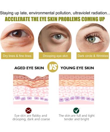 Under Eye Masks - 5pairs 24K Under Eye Patches - Eye Masks Skincare for Puffy Eyes Dark Circles Bags Gold Eye Pads Anti-Aging Hyaluronic Acid Moisturiser Remove Eye Bags Hydrating - Buy Online on SooperMarket.com