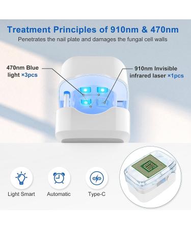 Nail Fungus Treatment Kit - Laser Device for Onychomycosis & Ingrown Toenail - Improves Nail Health with Blue Light - Buy Online on SooperMarket.com