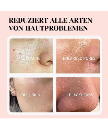 Dead Sea Mask Deep Cleansing Face Mask Skin Care Improve Blackheads Acne Dark Spots Even Skin Tone Face Mask Control Oil Refining Pores (Pink) - Buy Online on SooperMarket.com