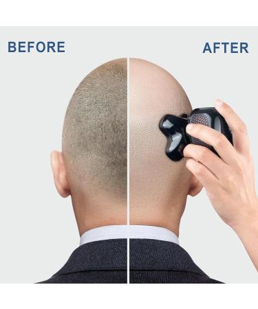 Upgrade Magnetic Head Shaver for Bald Men - Cordless 5-in-1 Electric Razor | IPX7 Waterproof Wet/Dry Grooming Kit | Easy Palm Shaver for a Smooth Shave - Buy Online on SooperMarket.com