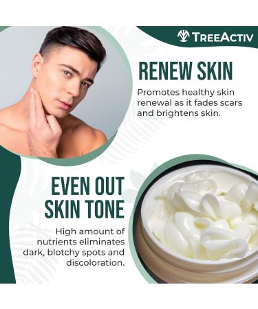 TreeActiv Acne Scar Cream - Effective Treatment for Face & Body Scars Stretch Marks 500+ Uses - All Skin Types - Buy Online on SooperMarket.com