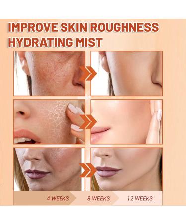 Vitamin C Face Mist VC Skin Brightening Facial Spray Skin Barrier Repair Improve Uneven Skin Relieves Dark Spots Spray Moisturiser VC Hydrating Serum Spray Deeply Moisturizing - Buy Online on SooperMarket.com