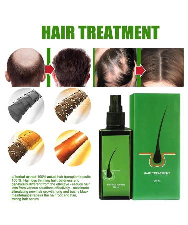 Neo Hair Lotion 120ml - Revitalize and Strengthen Your Hair - Buy Online on SooperMarket.com