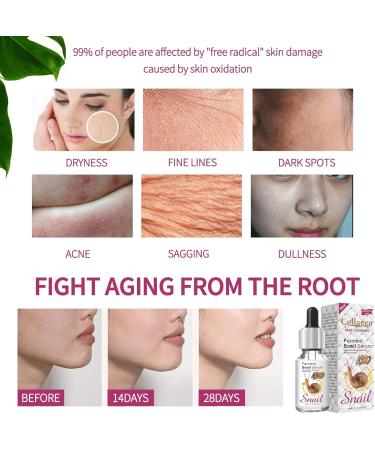Snail Collagen Serum Snail Mucin Repair Serums Hyaluronic Acid Snail Secretion Filtrate Face Serum Natural Pure Snail Anti Aging Serum For Face Skincare Serum Cruelty Free35ml - Buy Online on SooperMarket.com
