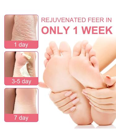 5-Pack Peach Foot Mask for Soft Callus and Dead Skin Removal - Exfoliating Socks for Dry Rough Heels Treatment - Natural Beauty Feet Mask - Buy Online on SooperMarket.com