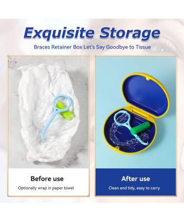 Annhua Retainer Case Denture Container Mouthguard Storage Box with Magnetic Closure False Teeth Container Denture Box Blue - Buy Online on SooperMarket.com