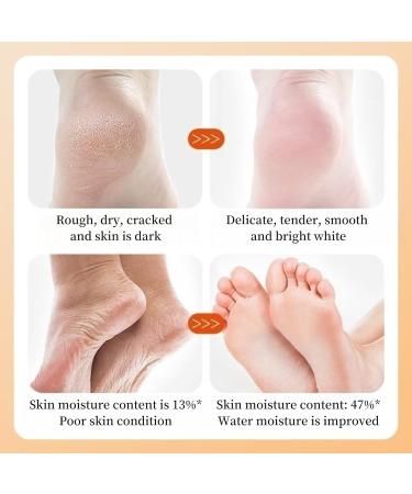 TBeautfave Foot Peel Mask 2 Pack Exfoliating Foot Mask Vitamin C Moisturizing Socks Feet Hard Skin Remover Feet Peeling Socks Whitening and Nourishing Foot Mask Foot Care Extra Long Foot Mask - Buy Online on SooperMarket.com