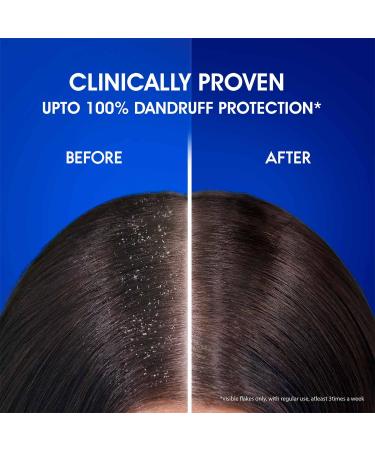 Buy Head & Shoulders Silky Black Anti-Dandruff Shampoo 340ml | International Shipping Available - Buy Online on SooperMarket.com