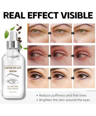 Caffeine Eye Serum for Dark Circles Organic Caffeine Eye Lifting Serum Anti Aging Under Eye Serum Caffeine Eye Cream for Dark Circles and Puffy Eyes Skincare Anti Wrinkle Eye Bag Removal - Buy Online on SooperMarket.com