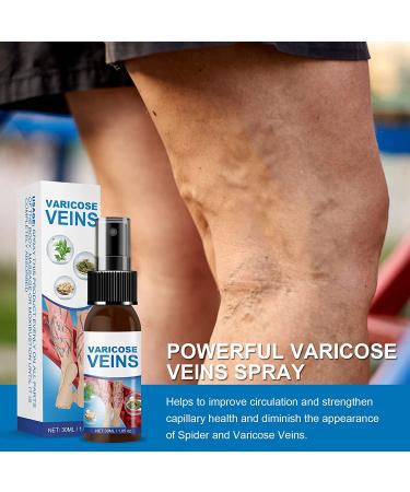 Varicose Veins Miracle Spray: Treatment for Legs to Improve Blood Circulation, Soothe Spider Veins and Relieve Tiredness - Buy Online on SooperMarket.com
