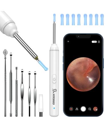 VITCOCO Ear Wax Removal Kit 1920P Wireless Ear Cleaner with Camera with 6 LED Lights 3mm Visual Ear Otoscope for iPhone Android iPad (White)