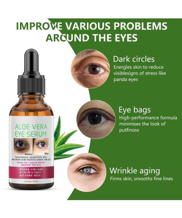 Aloe Vera Anti Aging Eye Serum | Dark Circle & Puffiness Treatment for Women - Buy Online on SooperMarket.com