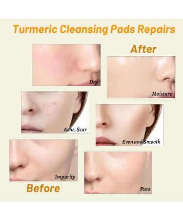 60 Turmeric Cleansing Pads for Face Exfoliating Scrubs with Vitamin C & B5 for Acne & Scars | International Shipping Available - Buy Online on SooperMarket.com