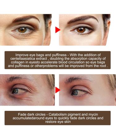 2pcs Silk Protein Anti-Aging Eye Cream for Wrinkles, Dark Circles, Fine Lines - Firming & Repair Eye Serum - Buy Online on SooperMarket.com
