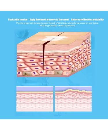 Skin-Friendly Zip Stitch Sutures - Breathable & Adjustable 2 Pack for Emergency Wound Closure - Buy Online on SooperMarket.com