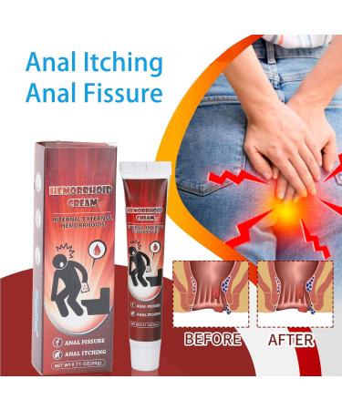 Maximum Strength Aloe Cream for Swelling & Discomfort Relief - Fissure Ointment - Buy Online on SooperMarket.com