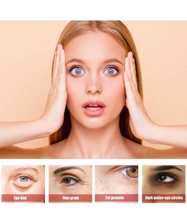 Speedy Milia Remover Milia Remover Milia Remover Under Eyes Milia Spot Serum for Face Helps Dissolve and Reduce Milia Dark Spot Remover to Reduce Milia Dark Circles Under Eye for Women & Men - Buy Online on SooperMarket.com