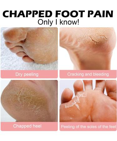 Cracked Heel Repair Cream Stick Foot Moisturizing Stick Foot Cream For Very Dry Feet Foot Cream For Calluses And Hard Skin Foot Moisturiser Callus Remover Soften For Feet Knees Hand - Buy Online on SooperMarket.com