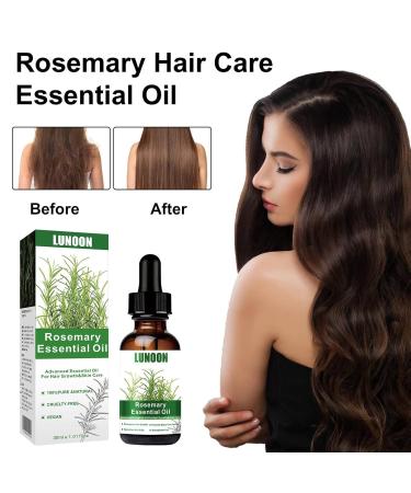 Troonz Rosemary Oil for Hair Growth | 60ml Natural Remedy for Hair Loss Nourishes Scalp & Damaged Hair - Buy Online on SooperMarket.com