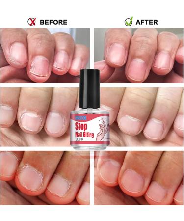 Quick Drying Anti Nail Biting Nail Polish - Nail Biting Prevention For Kids - Stop Nail Biting Nail Varnish - Nail Biting Prevention For Adults & Children Fast And Easy Application - Buy Online on SooperMarket.com