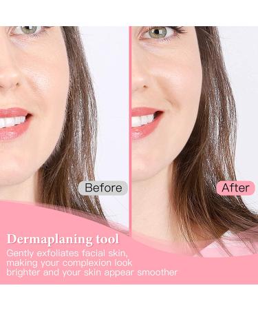 Professional Dermaplane Razor for Women | Peach Fuzz & Facial Hair Removal Tool with 3 Eyebrow Razors - Buy Online on SooperMarket.com