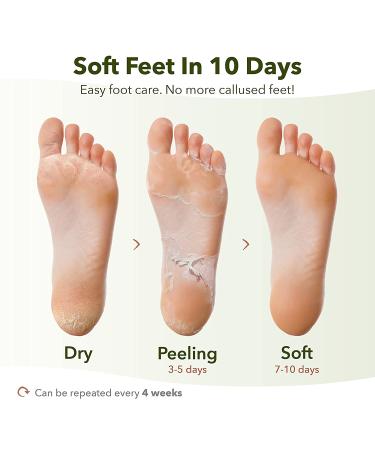 PURDERM Shiny & Soft Foot Peeling Mask (6 Pack) - Exfoliating Treatment for Cracked, Dry, Callused Feet - Removes Dead Skin & Reveals Baby Soft, Smooth Skin - Lemon & Natural Botanical Extracts - Buy Online on SooperMarket.com