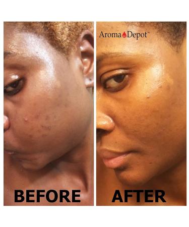 Aroma Depot Raw African Black Soap 1/2 Gallon - 100% Natural for Acne, Eczema, Psoriasis - Handmade from Ghana - Buy Online on SooperMarket.com