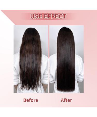 Onion & Rosemary Shampoo for Hair Growth | Biotin Anti Hair Loss Shampoo 16.76 fl oz - Buy Online on SooperMarket.com