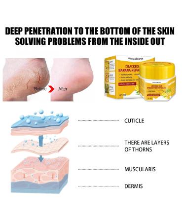 Anti-Dry Skin Foot Cream | Nourishing Moisturizer for Dry Feet - A Size | International Shipping Available - Buy Online on SooperMarket.com