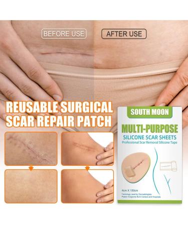Silicone Scar Gel Strip - Efficient Scar Treatment for Surgery, Acne & Trauma - 4 * 150cm - Buy Online on SooperMarket.com
