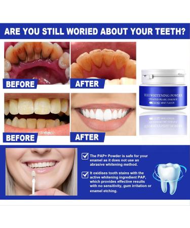 Professional Teeth Whitening Powder - 1.1 oz Charcoal Formula for Coffee & Tobacco Stain Removal - Effective Tooth Whitener - Buy Online on SooperMarket.com