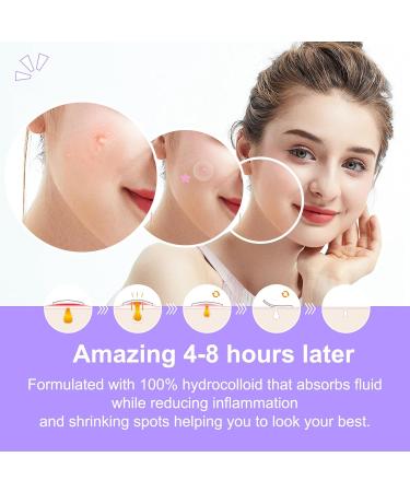 Acne Patch Pimple Patches Stars Heart-Shaped Acne Patches Hydrocolloid Dressing Cover Dots for Spots Pimple Patches Effectively Calms & Relieves Acne 156 Patches(12mm&8mm) - Buy Online on SooperMarket.com
