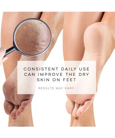 LE EMILIE 5 Toe Moisturizing Gel Socks | Healing Dry Cracked Heels | Lavender & Jojoba Oil Blend | 1 Pair Green Seafoam - Buy Online on SooperMarket.com