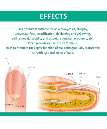 Kerassentials Toenail Treatment Oil - 4PCS Natural Nail Treatment for Repairing and Strengthening - Buy Online on SooperMarket.com