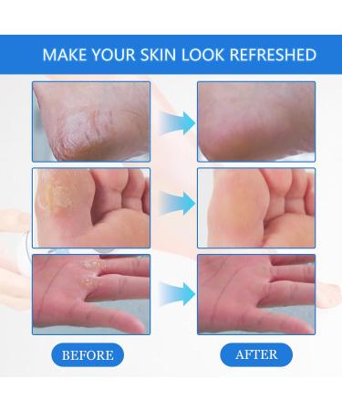 Electric callus remover callus remover foot care device pedicure set foot care callus remover callus remover foot care device with 6 attachments - Buy Online on SooperMarket.com