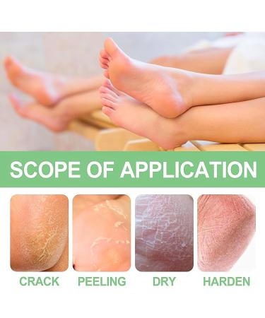 Trendyfave Foot Care Cream Foot Cream For Cracked Heels And Dry Skin Cracked Heel Repair Cream With Vitamin C And Aloe Vera For Deep Moisturizing Callus Remover And Soften Skin Care Hands & Feet - Buy Online on SooperMarket.com