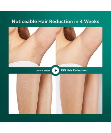 AMINZER 2023 IPL Hair Removal Device 3-in-1 Functions HR/SC/RA | 9 Energy Levels | 999900 Flashes | Painless Laser Hair Removal Device with LCD Touch Screen - Buy Online on SooperMarket.com