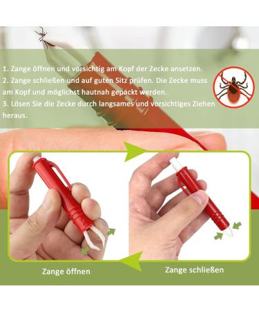 Nepfaivy Tick Pliers for Dogs Cats & Humans - 2 Set Tick Tweezers for Safe Easy Tick Removal of All Sizes - Buy Online on SooperMarket.com