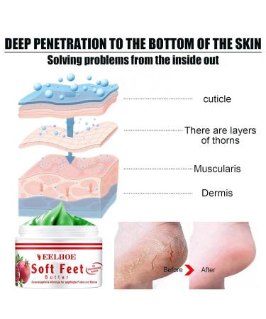 Intensive Regenerating Foot Cream - Ultimate Foot Care Balm for Dry Feet & Cracked Heels - 1g | Soothing Relief for All Skin Types - Buy Online on SooperMarket.com