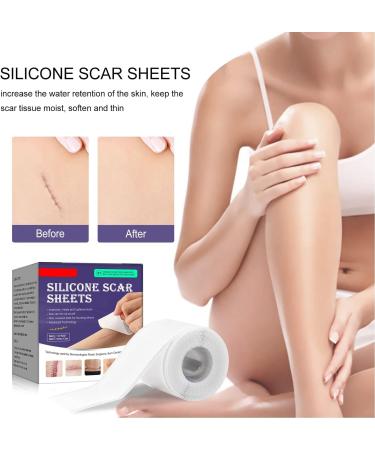 Silicone Scar Tape Roll - Multipurpose, Moisturizing, and Safe for Repeated Sticking - Buy Online on SooperMarket.com
