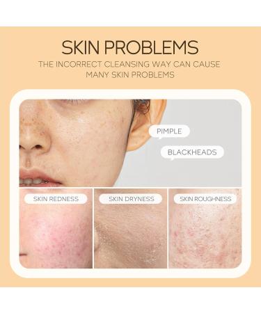 Vitamin C Hydrating Foaming Facial Cleanser - Gentle Acne-Prone Skin Wash with Silicone Brush - Vegan Daily Cleanser for Men & Women - 4.2oz - Buy Online on SooperMarket.com