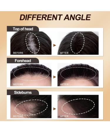 Sularpek Hairline Powder Hairline Powder Instantly Conceals Hair Loss Hairline Shadow Powder for Thinning Hair for Women and Men Bald Spots Eyebrows Beard Line Dark Brown - Buy Online on SooperMarket.com