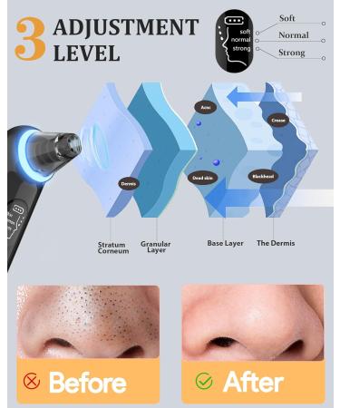 Black Head Remover Tools Blackhead Pore Vacuum: Electric Facial Pore Cleaner 3 Suction Levels Rechargeable Pimple Comedone Extractor Skin Care for Face - Buy Online on SooperMarket.com