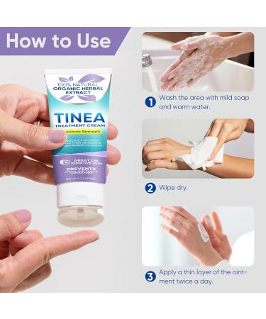 Tinea Versicolor Natural Skin Cream - Effective Treatment for All Skin Types - Buy Online on SooperMarket.com